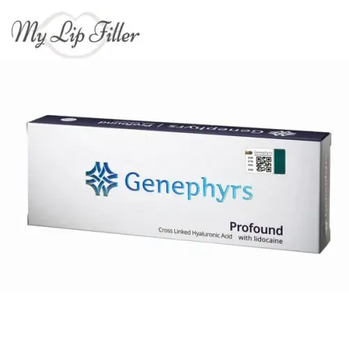 Genephyrs Stream Line (1 x 1.1ml) - My Lip Filler