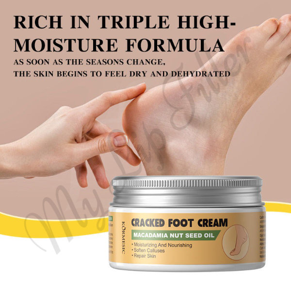 Kormesic Macadamia Nut Seed Oil Cracked Foot Cream by mylipfiller.com - photo 2 Kormesic Macadamia Nut Seed Oil Cracked Foot Cream - My Lip Filler - photo 2