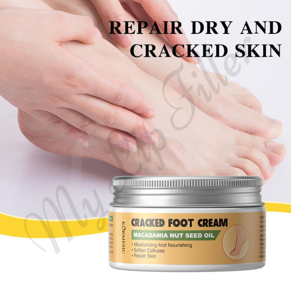 Kormesic Macadamia Nut Seed Oil Cracked Foot Cream by mylipfiller.com - photo 4 Kormesic Macadamia Nut Seed Oil Cracked Foot Cream - My Lip Filler - photo 4