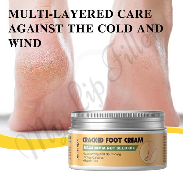 Kormesic Macadamia Nut Seed Oil Cracked Foot Cream by mylipfiller.com - photo 5 Kormesic Macadamia Nut Seed Oil Cracked Foot Cream - My Lip Filler - photo 5