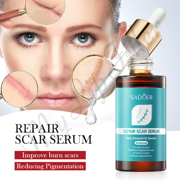 Sadoer Scar Repair Serum by mylipfiller.com - photo 3 Sadoer Scar Repair Serum - My Lip Filler - photo 3