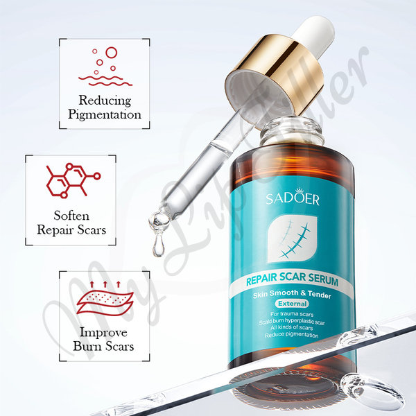 Sadoer Scar Repair Serum by mylipfiller.com - photo 4 Sadoer Scar Repair Serum - My Lip Filler - photo 4